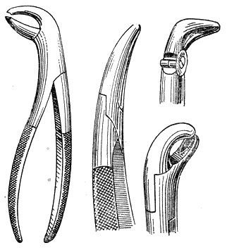 71.     (pulpitis).    