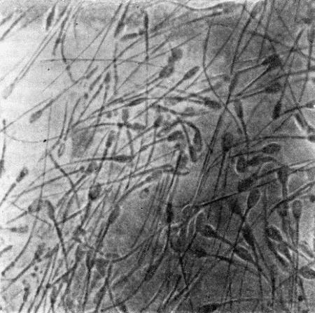 Рис. 115. Нормальная сперма кобеля под микроскопом (увеличение в 635)Объем спермы,