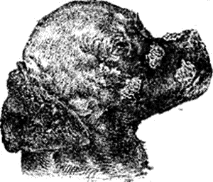 30. Парша (Favus) на голове (лице) собакиПлесневые грибки, вызывающие паршу и