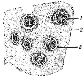 Рис. 30. Хрящевая ткань1 — хрящевая клетка; 2 — основное вещество; 3 — капсула